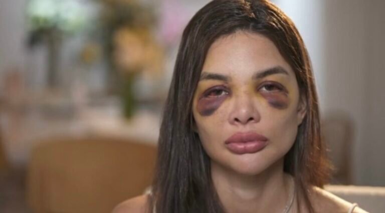 Dentista relata ao ‘Fantástico’ agressões que sofreu do marido, empresário da Faria Lima